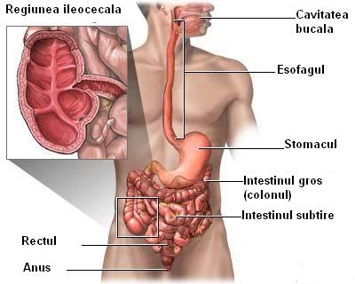 Boala crohn